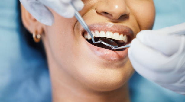 Best Walk-In Emergency Dental Services in Lake Magdalene, FL