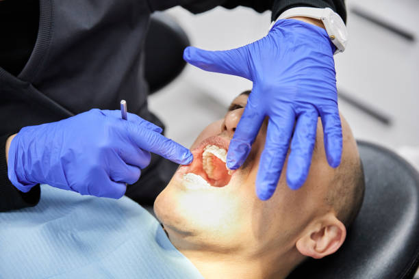 Best Emergency Root Canal Therapy in Lake Magdalene, FL